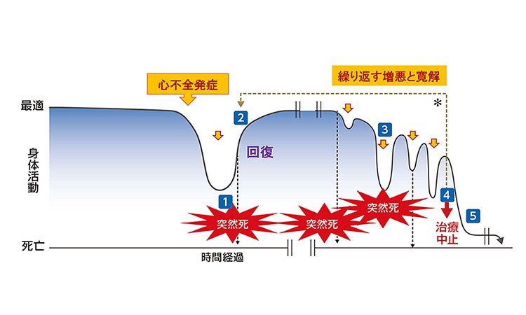 Vol.34：あらゆる心臓病の行きつくところ“心不全”　陥らない  悪化させない  その予防法