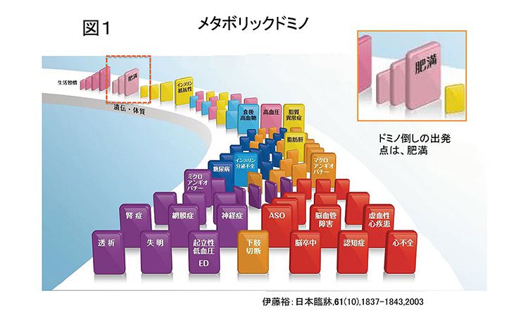 Vol.22：“メタボリックドミノ”　一気に進むメタボの連鎖