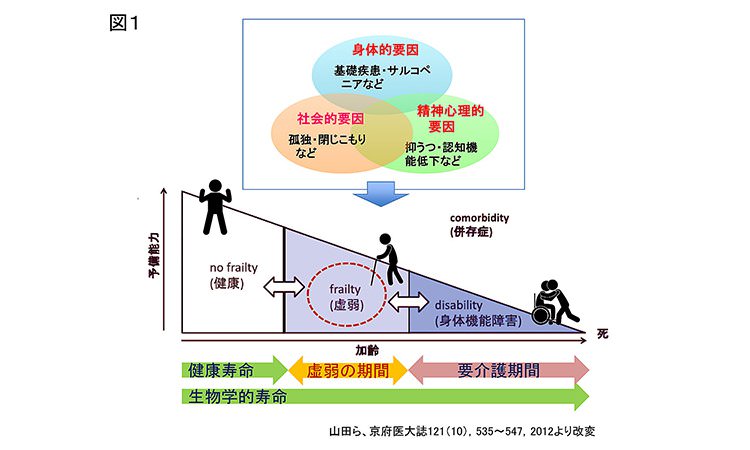 Vol.27：フレイルティ（虚弱）を回避せよ！介護状態を避け 健康寿命を延ばすために