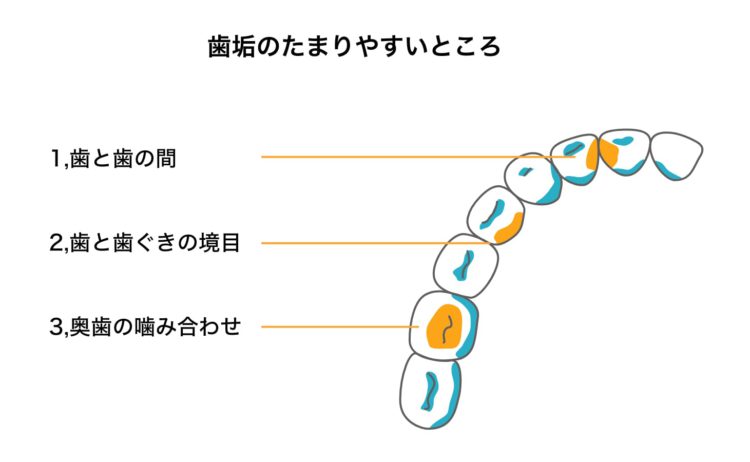 歯は健康のバロメーター　オーラルフレイルを防ぎましょう